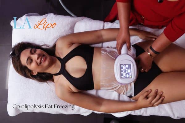 woman getting cryolipolysis Bicester
