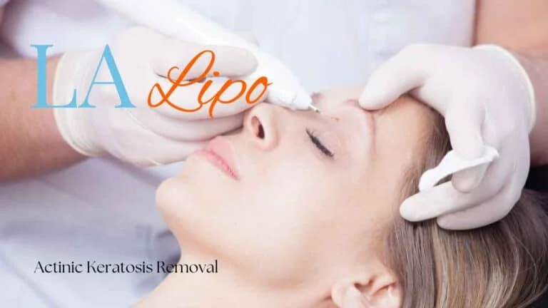 Woman receiving Actinic Keratosis Removal Treatment Bicester