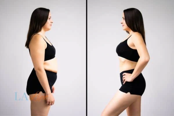 LA-EMS Body Sculpting Bicester results before and after of womans results on body toning.