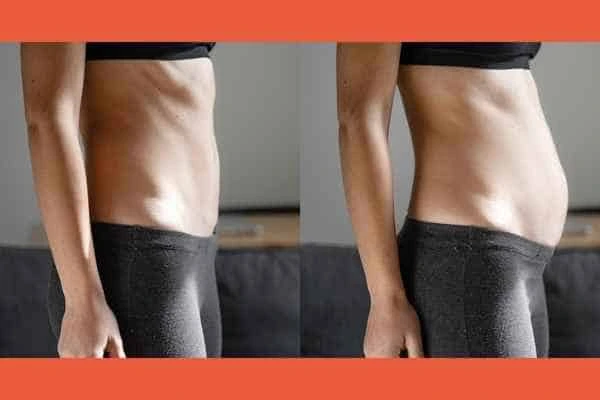 LA-EMS Body Sculpting results Bicester