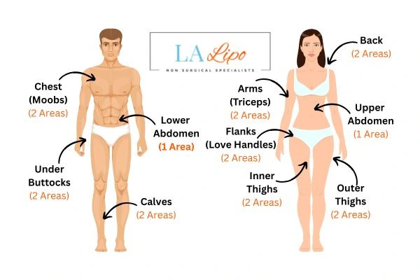 LA LIPO Cryolipolysis Areas Bicester