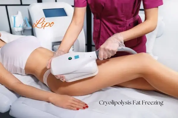 Woman receiving coolsculpting Bicester treatment on her thighs