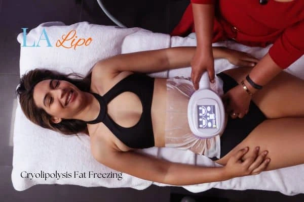 woman getting cryolipolysis Bicester
