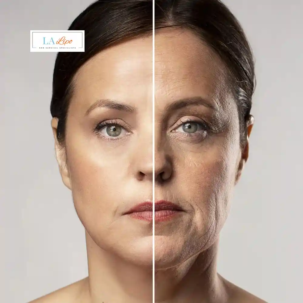 How Can You Tell If Non-Surgical Skin Tightening Is Right for You Bicester?
