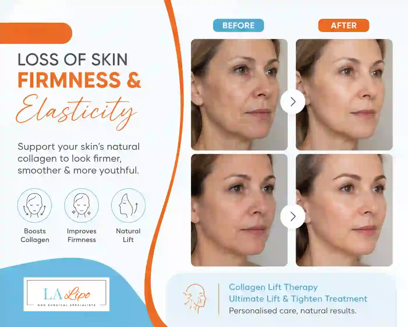 Sign #7: Loss of Skin Firmness and Elasticity Bicester