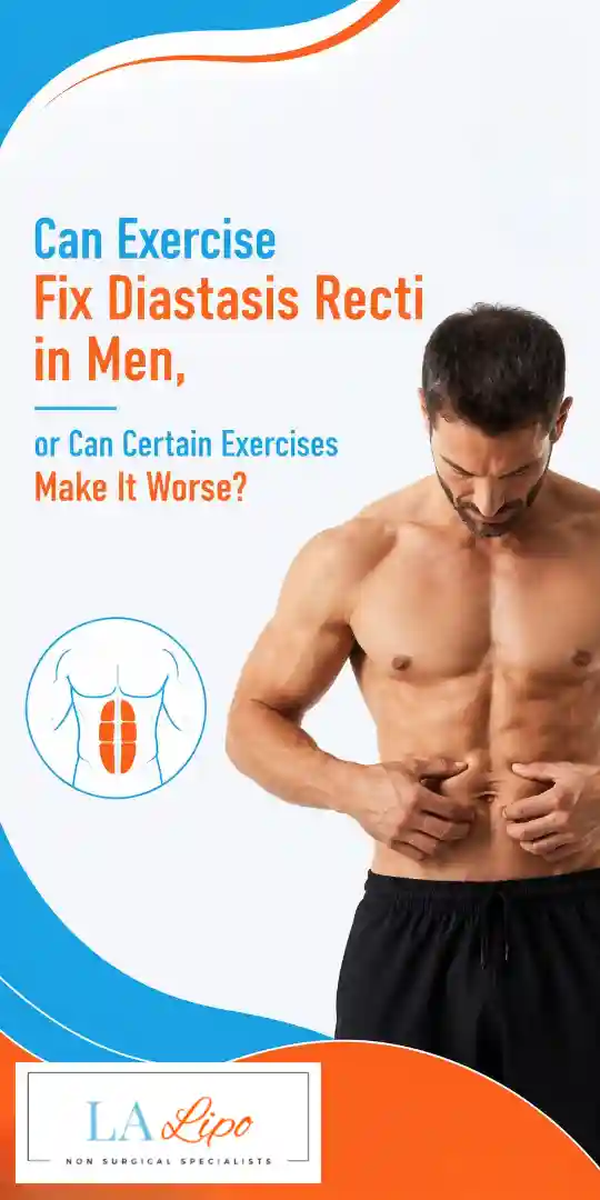 Can Exercise Fix Diastasis Recti in Men, or Can Certain Exercises Make It Worse Bicester?